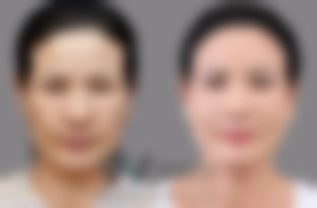 韩国原辰整形外科医院