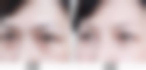 八、北京瑞妍茗医医疗美容医院真实的患者评价