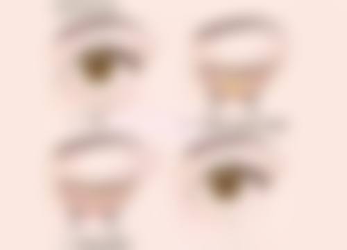 三、影响手术成效的关键因素