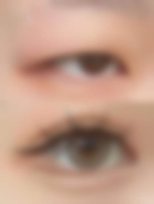 九、韩国thetop整形外科真实的患者评价