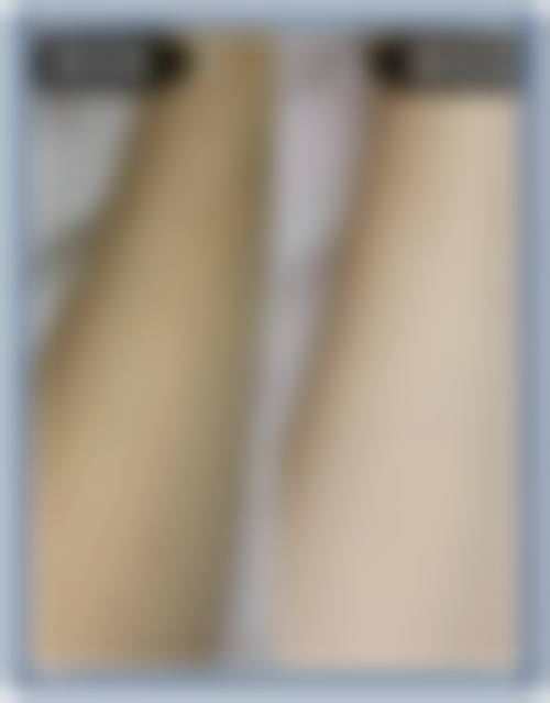 六、浙江嘉兴平湖爱尚口腔诊所价格表