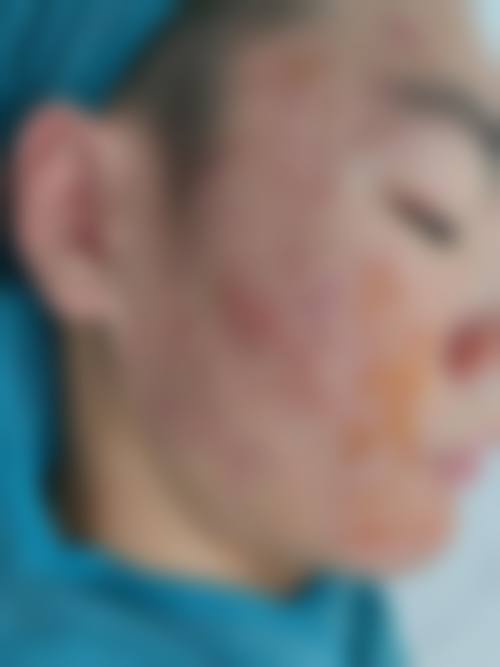 九、长沙春语医疗美容门诊部真实的患者评价