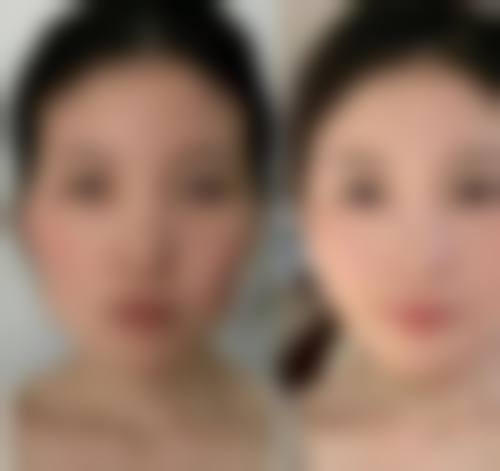 四、西安叽叽肌医疗美容诊所特色项目