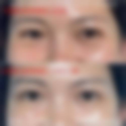 九、杭州美伊典医疗美容诊所真实的患者评价