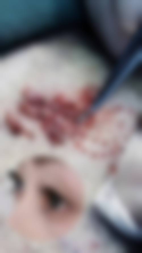 三、运城市皮肤病医院医学美容科诊疗项目有哪些？