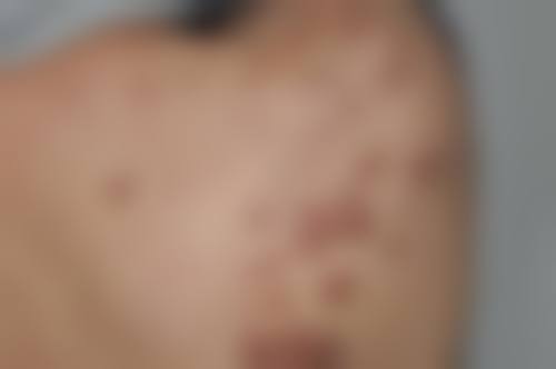 七、运城市皮肤病医院医学美容科地址及交通