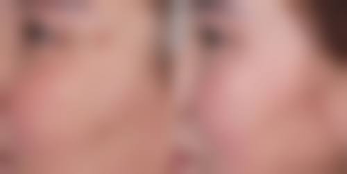 六、卢泰浩真实的患者评价