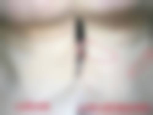 八、上海喻德军整形医院真实的患者评价