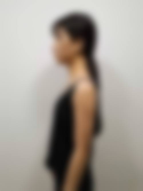 六、重庆玺雅医疗美容诊所价格表