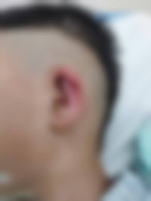 四、铜陵市中医医院美容科特色项目