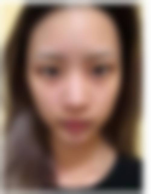 九、衢州芘丽芙整形医疗美容门诊部真实的患者评价