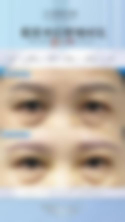 六、长沙春语医疗美容门诊部价格表