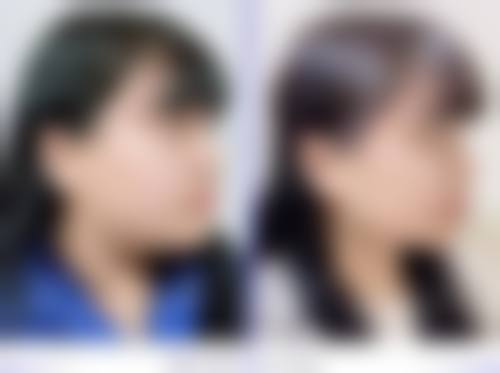 九、重庆玺雅医疗美容诊所真实的患者评价