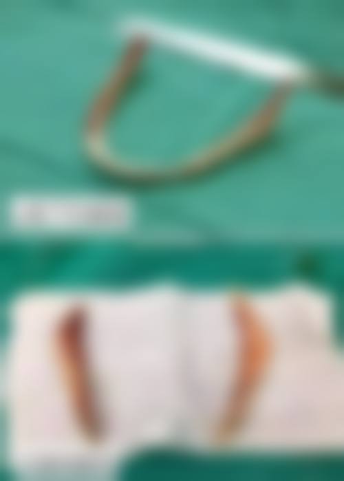 二、韩国thetop整形外科怎么样？