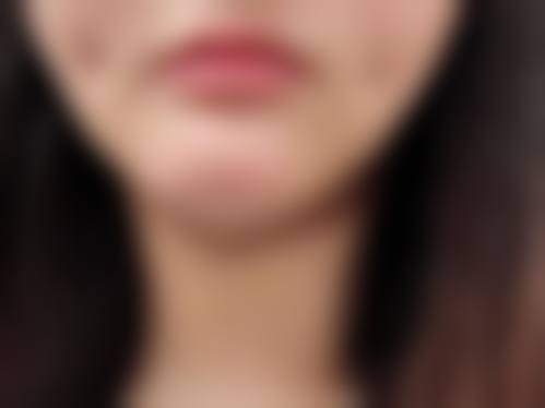 九、沈阳臻瑞恒美医疗美容门诊部真实的患者评价