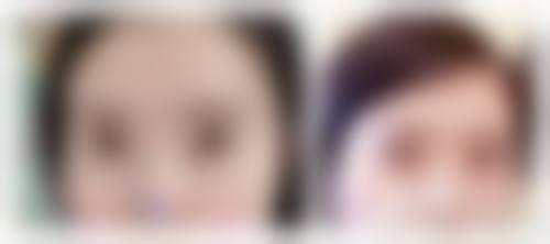 九、苏州婉美整形医疗美容诊所真实的患者评价