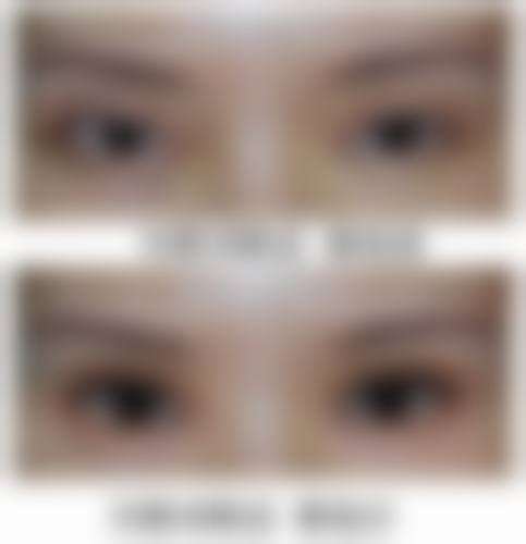 五、深圳瓷美汇医疗美容门诊部价格表