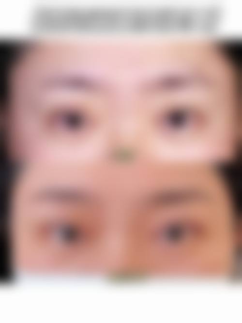 三、蚌埠市第三人民医院烧伤整形科诊疗项目有哪些?