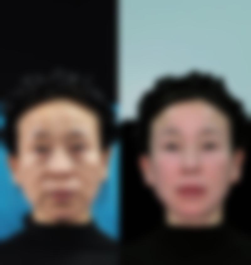 三、严格防晒与保湿