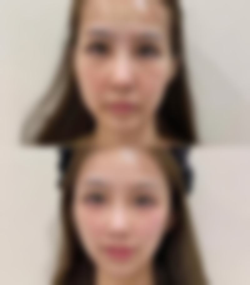 九、重庆常青藤美伽整形美容医院真实的患者评价