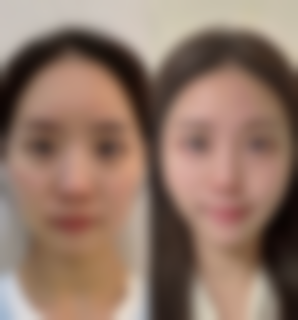 一、避免瘢痕受到刺激