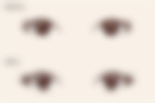 一、溶脂和抽脂的原理区别