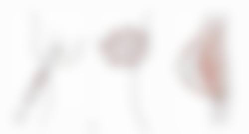 五、去眼袋手术费用承担建议