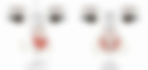 四、去眼袋手术走医疗保险的例外情况