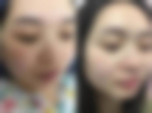 六、衢州美莱整形美容医院价格表