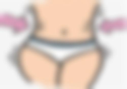 四、双眼皮形态改变后的改善方法