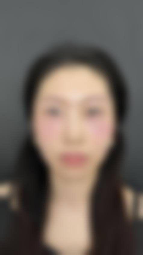 四、南宁檀悦双美医疗美容诊所特色项目