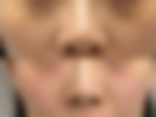 四、西安嘉那医疗美容诊所特色项目