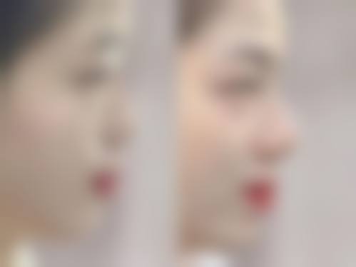 二、南宁檀悦双美医疗美容诊所怎么样？