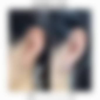 八、宜宾翠屏莱奥整形医疗美容门诊部真实的患者评价