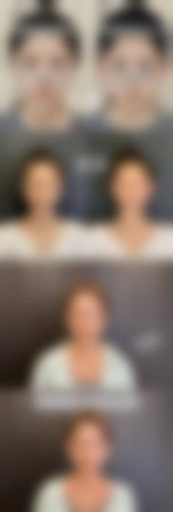 四、郑州安琪儿医疗美容门诊特色项目