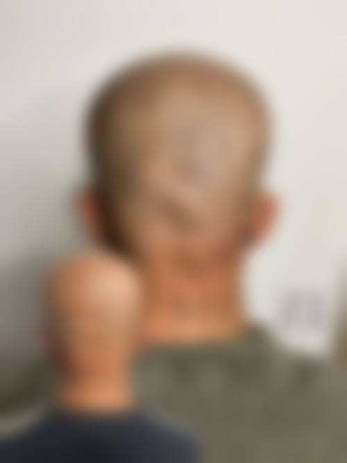 六、毕森森真实的患者评价