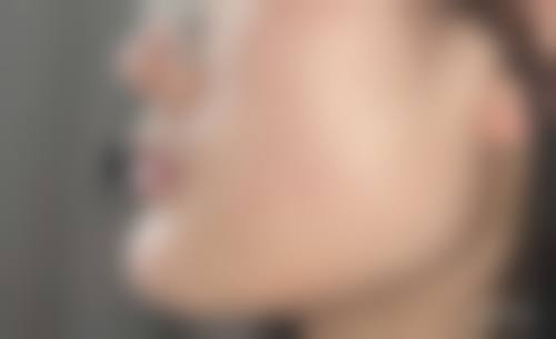 三、成都武侯初颜医疗美容门诊部诊疗项目有哪些？