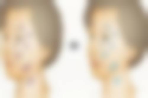 四、做双眼皮手术前的其他注意事项