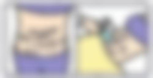 二、做双眼皮手术前的身体准备要点