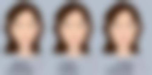 三、做双眼皮手术前的心理预期要点