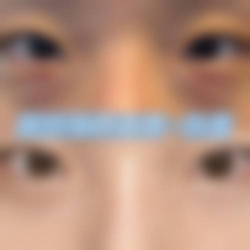 四、随州蒋留留医疗美容诊所特色项目