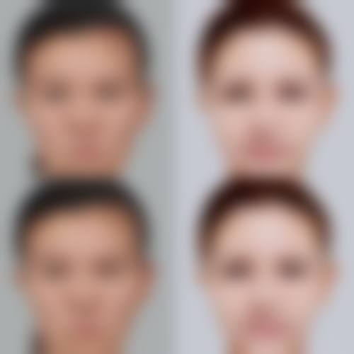 四、石家庄悦美医疗美容门诊部特色项目