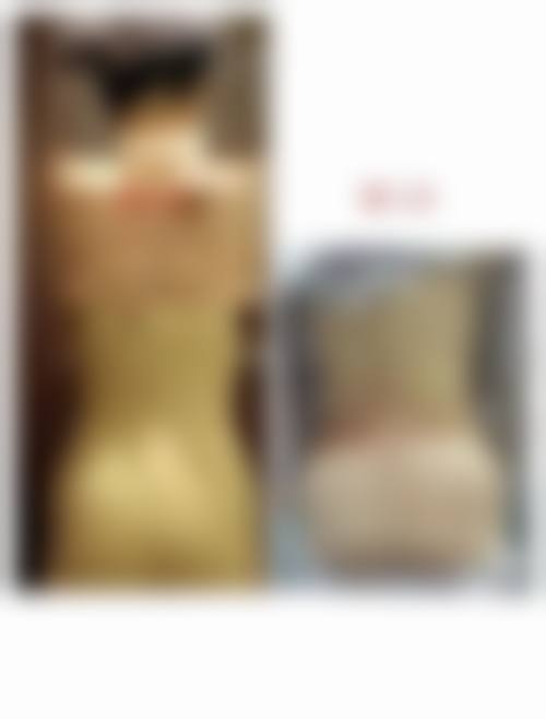 八、随州蒋留留医疗美容诊所真实的患者评价