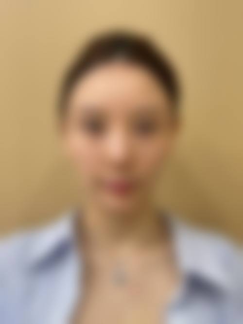 九、衡阳美莱整形医疗美容医院真实的患者评价