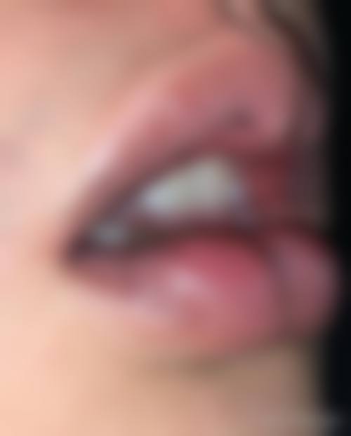 六、衡阳美莱整形医疗美容医院价格表