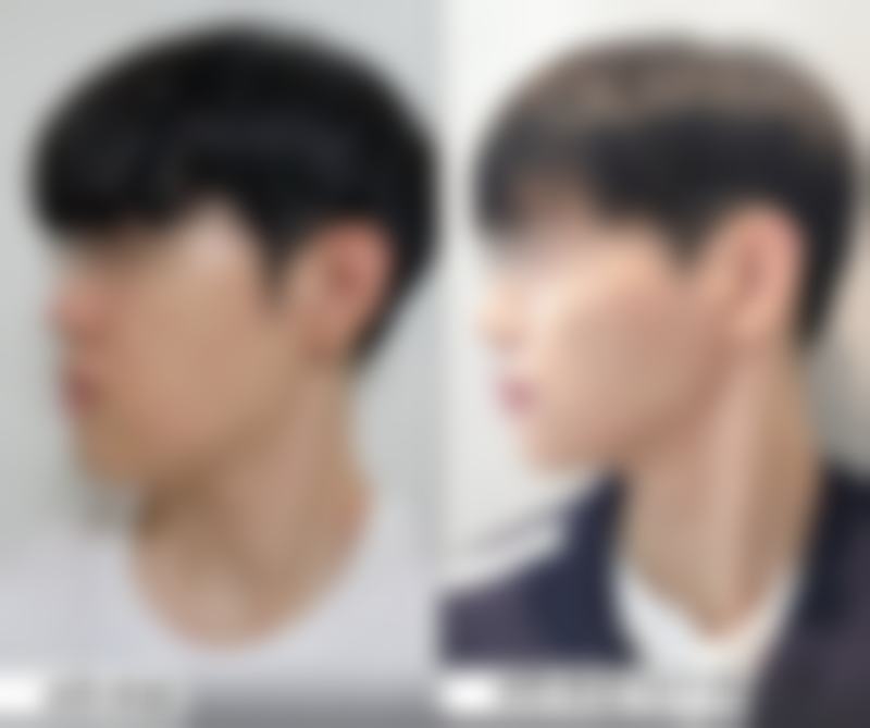 巴婷美疤痕修复中 心怎么样？