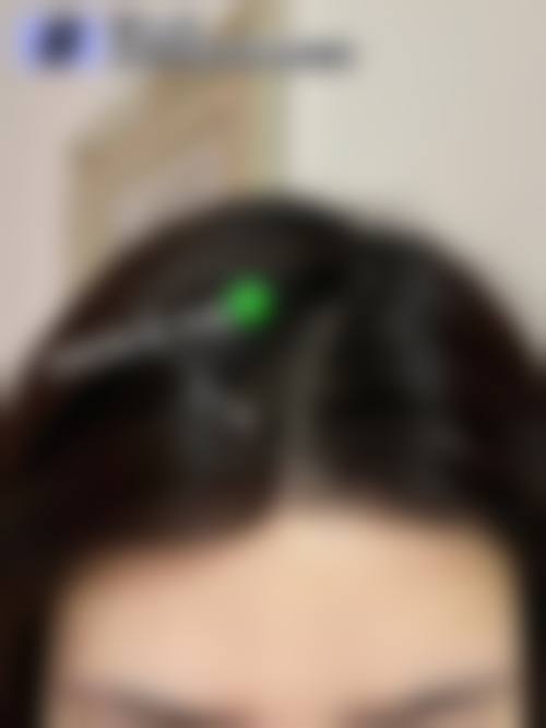 二、周杏翠擅长项目