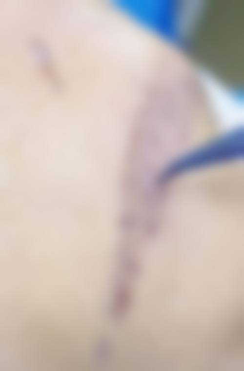 五、周杏翠怎么预约？