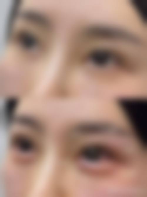 九、福州市晋安区久植因美医疗美容门诊部真实的患者评价