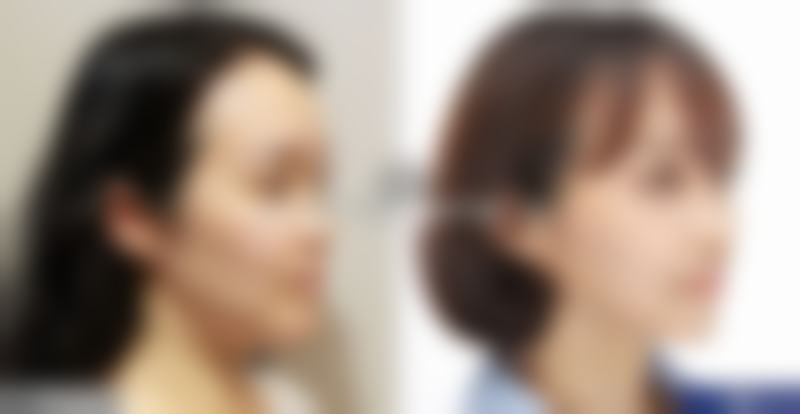 四、不同阶段适用的护理产品